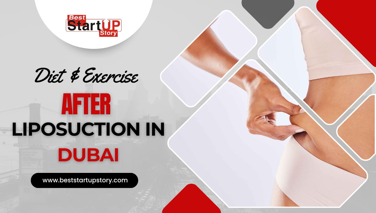 Diet & Exercise Liposuction In Dubai